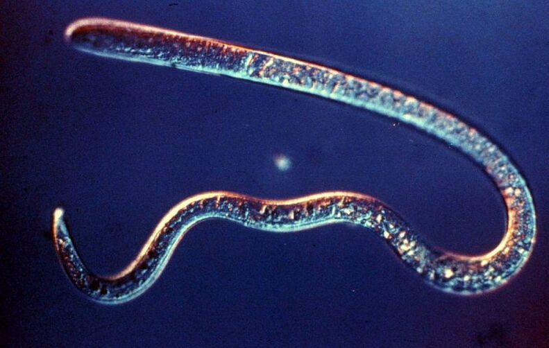 parazit červa z ľudského tela