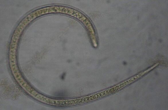 Trichinella je protostomický okrúhly parazitický červ